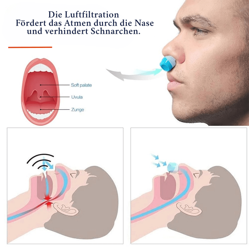 Anti Snoring Devices – image 4