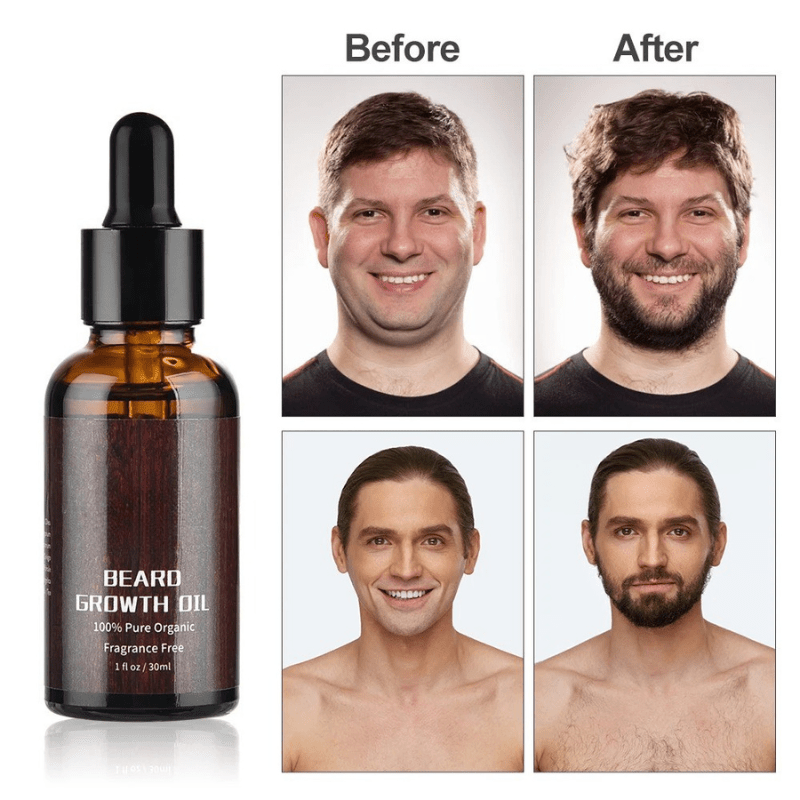 Beard Growth Kit with Derma Roller, Beard Balm – image 18